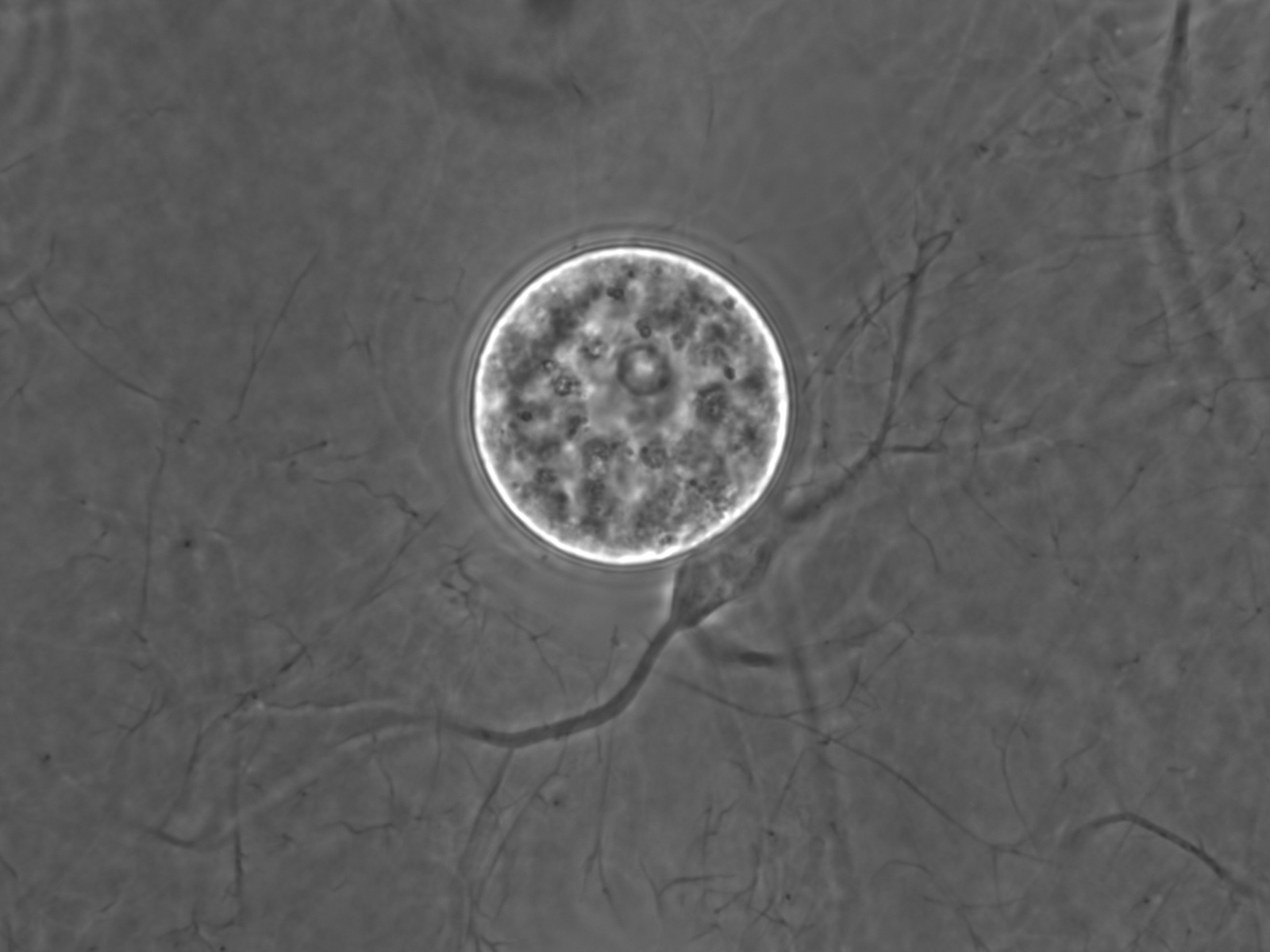Strain image